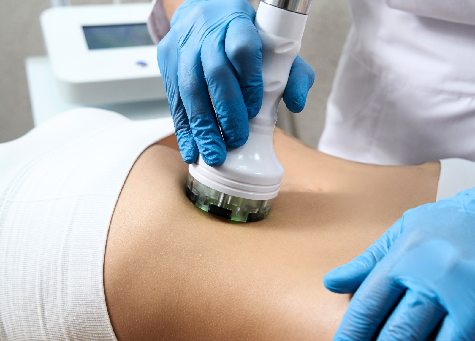 Sub-Zero treatment on a young woman